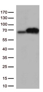 PKR (EIF2AK2) Antibody in Western Blot (WB)