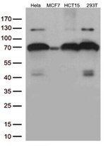PKR (EIF2AK2) Antibody in Western Blot (WB)