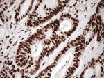 KAP1 (TRIM28) Antibody in Immunohistochemistry (Paraffin) (IHC (P))