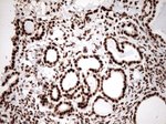 KAP1 (TRIM28) Antibody in Immunohistochemistry (Paraffin) (IHC (P))