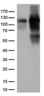 KAP1 (TRIM28) Antibody in Western Blot (WB)