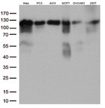 KAP1 (TRIM28) Antibody in Western Blot (WB)