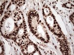 KAP1 (TRIM28) Antibody in Immunohistochemistry (Paraffin) (IHC (P))