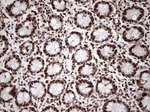 KAP1 (TRIM28) Antibody in Immunohistochemistry (Paraffin) (IHC (P))