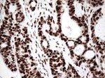 KAP1 (TRIM28) Antibody in Immunohistochemistry (Paraffin) (IHC (P))