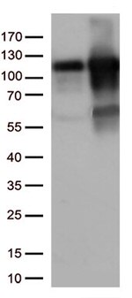 KAP1 (TRIM28) Antibody in Western Blot (WB)