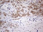 CFLAR Antibody in Immunohistochemistry (Paraffin) (IHC (P))