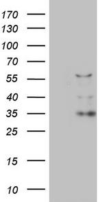 CFLAR Antibody in Western Blot (WB)