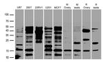 CGB7 Antibody in Western Blot (WB)