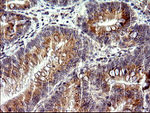 CHAC1 Antibody in Immunohistochemistry (Paraffin) (IHC (P))