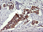 CHAC1 Antibody in Immunohistochemistry (Paraffin) (IHC (P))