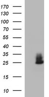 CHAC1 Antibody in Western Blot (WB)