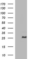 CHAC1 Antibody in Western Blot (WB)