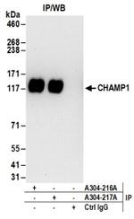 CHAMP1 Antibody in Western Blot (WB)