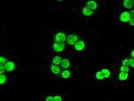 CHEK2 Antibody in Immunocytochemistry (ICC/IF)