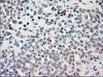 CHEK2 Antibody in Immunohistochemistry (Paraffin) (IHC (P))