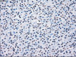 CHEK2 Antibody in Immunohistochemistry (Paraffin) (IHC (P))