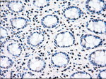 CHEK2 Antibody in Immunohistochemistry (Paraffin) (IHC (P))