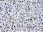 CHEK2 Antibody in Immunohistochemistry (Paraffin) (IHC (P))