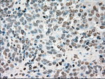 CHEK2 Antibody in Immunohistochemistry (Paraffin) (IHC (P))