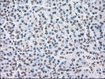 CHEK2 Antibody in Immunohistochemistry (Paraffin) (IHC (P))