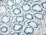 CHEK2 Antibody in Immunohistochemistry (Paraffin) (IHC (P))