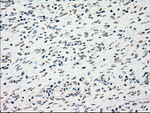 CHEK2 Antibody in Immunohistochemistry (Paraffin) (IHC (P))