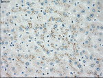 CHEK2 Antibody in Immunohistochemistry (Paraffin) (IHC (P))