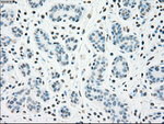 CHEK2 Antibody in Immunohistochemistry (Paraffin) (IHC (P))