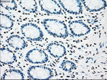 CHEK2 Antibody in Immunohistochemistry (Paraffin) (IHC (P))