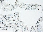 CHEK2 Antibody in Immunohistochemistry (Paraffin) (IHC (P))