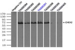 CHEK2 Antibody in Immunoprecipitation (IP)