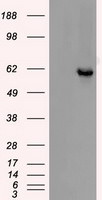 CHEK2 Antibody in Western Blot (WB)