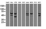 CHEK2 Antibody in Western Blot (WB)