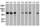 CHEK2 Antibody in Western Blot (WB)