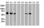 CHEK2 Antibody in Western Blot (WB)