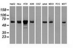 CHEK2 Antibody in Western Blot (WB)