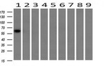 CHEK2 Antibody in Western Blot (WB)