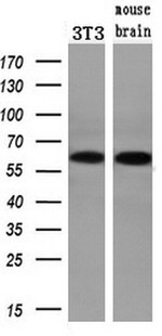 CHEK2 Antibody in Western Blot (WB)