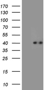 CHIA Antibody in Western Blot (WB)