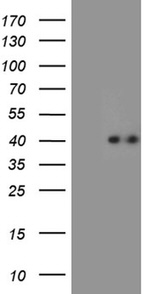 CHIA Antibody in Western Blot (WB)