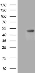 CHIA Antibody in Western Blot (WB)