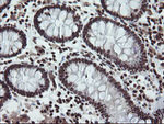 CHN1 Antibody in Immunohistochemistry (Paraffin) (IHC (P))