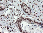 CHN1 Antibody in Immunohistochemistry (Paraffin) (IHC (P))