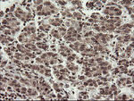 CHN1 Antibody in Immunohistochemistry (Paraffin) (IHC (P))