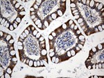 CHP1 Antibody in Immunohistochemistry (Paraffin) (IHC (P))