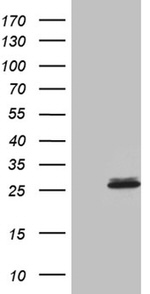 CHP1 Antibody in Western Blot (WB)