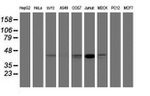 CHST6 Antibody in Western Blot (WB)