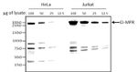 IGF2R Antibody in Western Blot (WB)