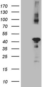 CIAPIN1 Antibody in Western Blot (WB)